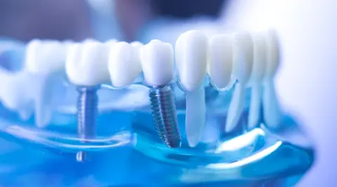 Foto di Dentamed - Odontoiatria Favetti Porta Maggiore