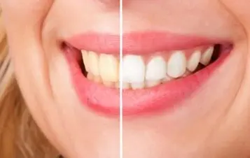 Foto di Studio Odontoiatrico Dottor Iannella Dentista Napoli