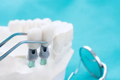 Foto di Dental Swiss Gallarate - Clinica Odontoiatrica
