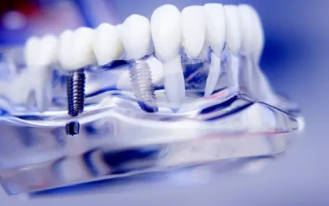 Foto di Sapa Dental