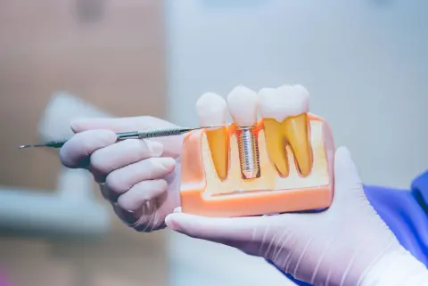 Foto di Studio Dentistico San Grato Di Grivet Feta' Mara C. Sas