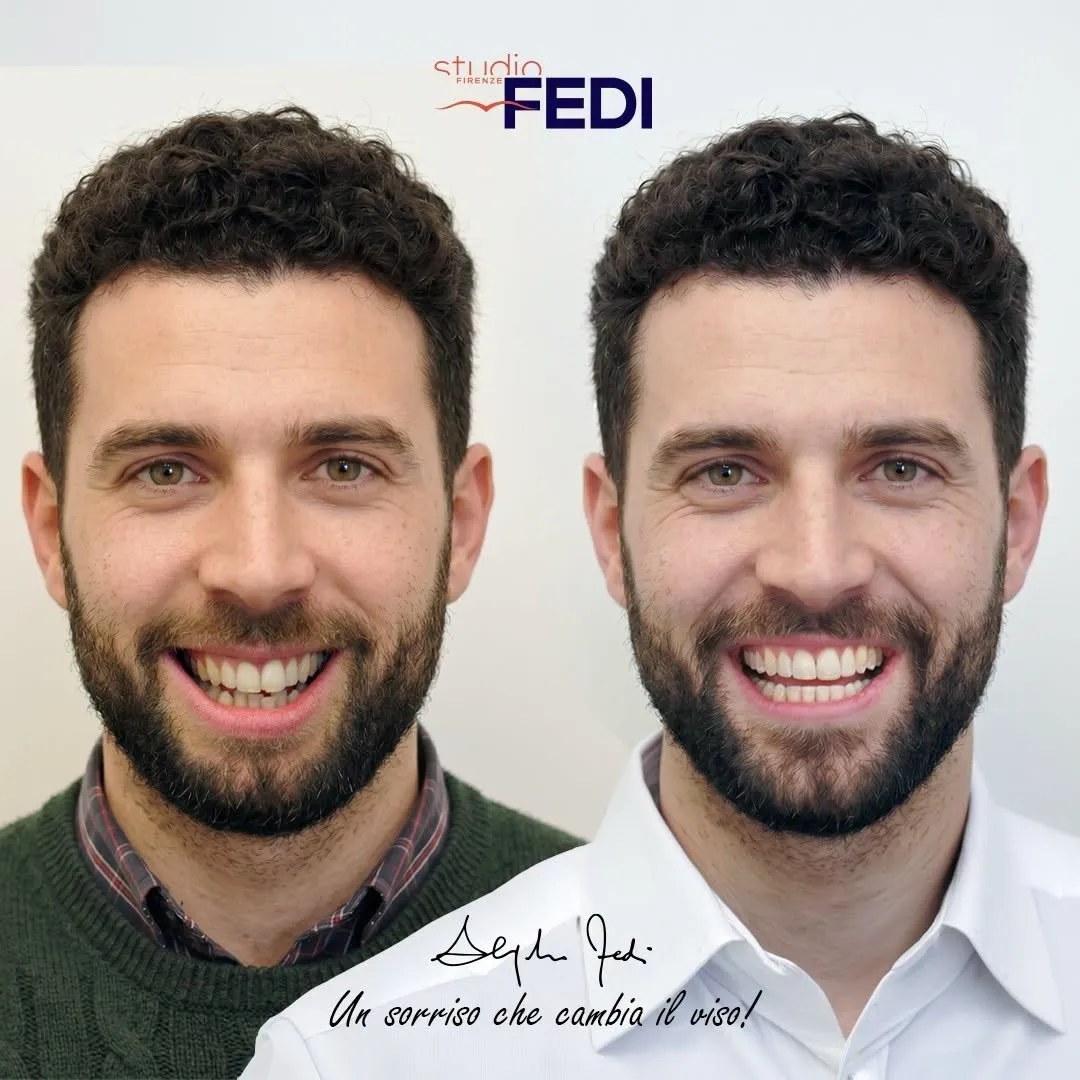 Foto dello studio