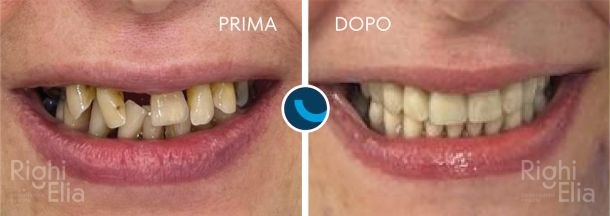 Caso clinico documentato