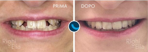 Caso clinico documentato